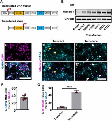 A Human TSC1 Variant Screening Platform in Gabaergic Cortical Interneurons for Genotype to Phenotype Assessments